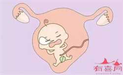 专业代孕包成功_胚胎染色体检查