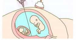 哪里有代孕医院_孕早期怎样知道宝宝好不好