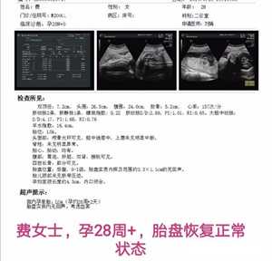 2020年广州代孕一个孩子多少钱_月子期间宝妈妈需要做好的方面有哪些