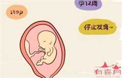 广东怀孕机构_分娩前要准备哪些东西