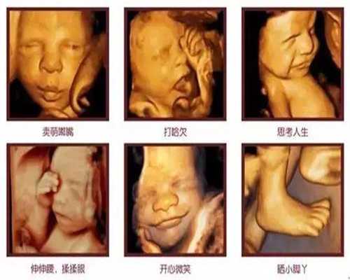 上海试管婴儿 包生儿子_上海试管婴儿长方案全流程_上海代招怀孕包生男孩_上