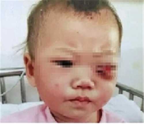 中国第一代孕机构：怀孕2个月不吐正常吗